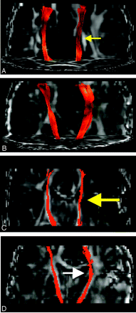 Fig 12.