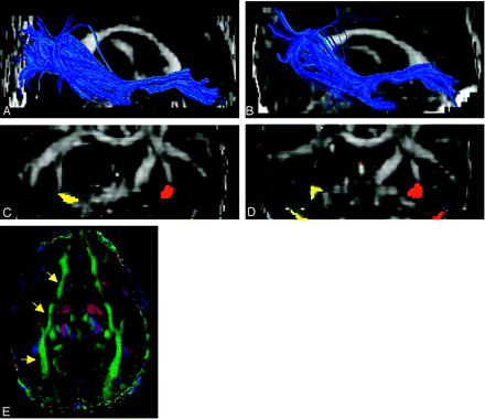 Fig 15.