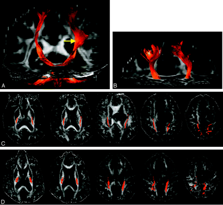 Fig 2.