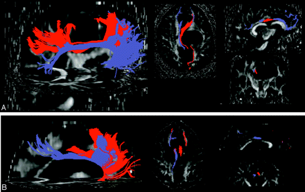 Fig 4.