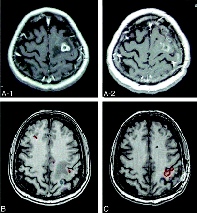 Fig 1.