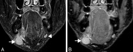 Fig 2.
