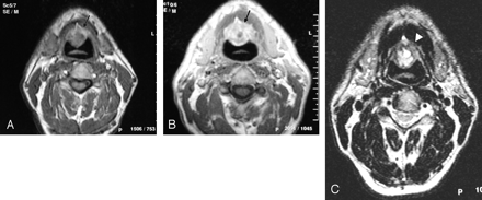 Fig 2.