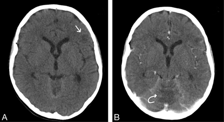 Fig 1.