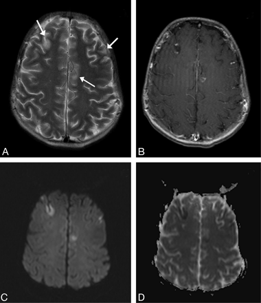 Fig 3.