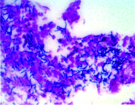 Fig 2.