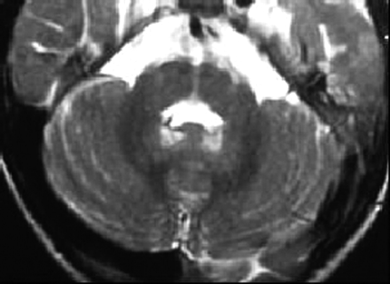 Fig 4.