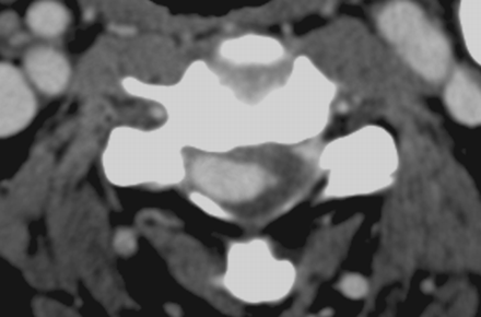 Fig 4.
