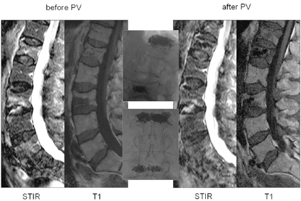 Fig 3.