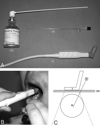 Fig 4.