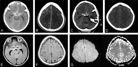Fig 5.
