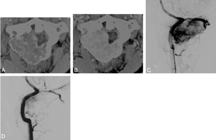   Fig 1. 