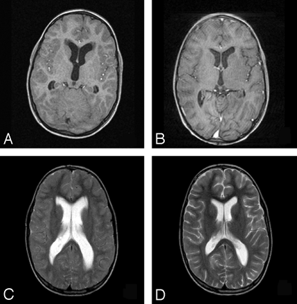 Fig 5.