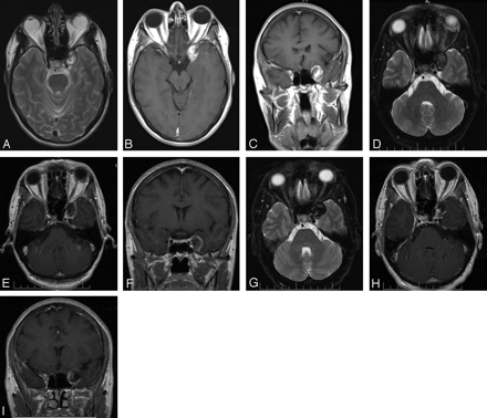 Fig 1.