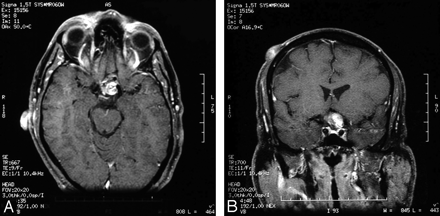 Fig 2.