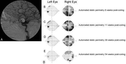 Fig 3.