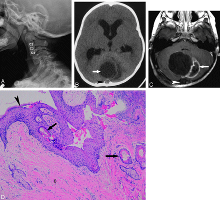 Fig 1.