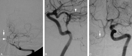 Fig 3.