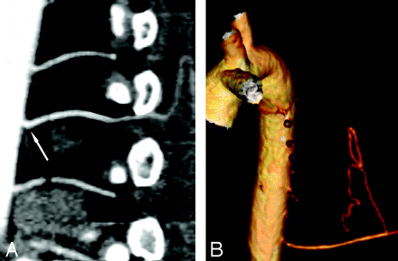 Fig 2.