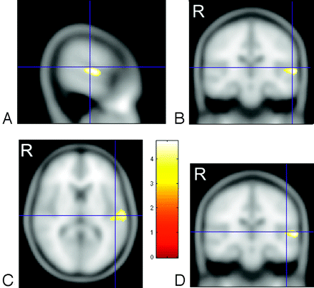 Fig 2.