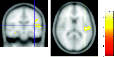 Fig 6.