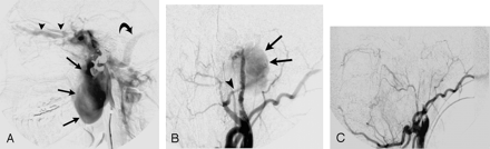 Fig 1.