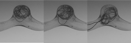 Fig 3.
