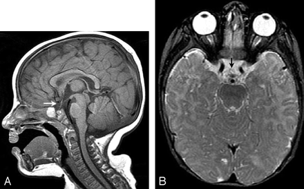 Fig 1.