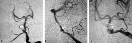 Fig 2.