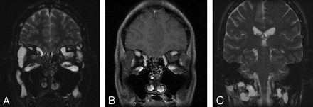 Fig 1.