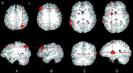 Fig 1.