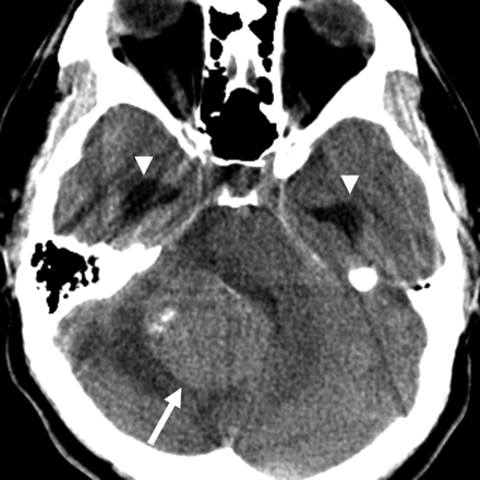 Fig 1.