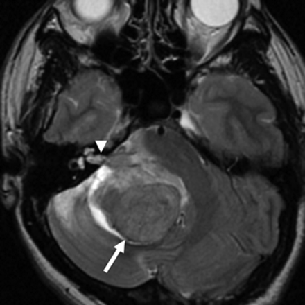 Fig 2.
