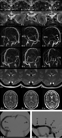 Fig 3.