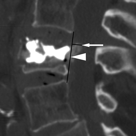 Fig 1.
