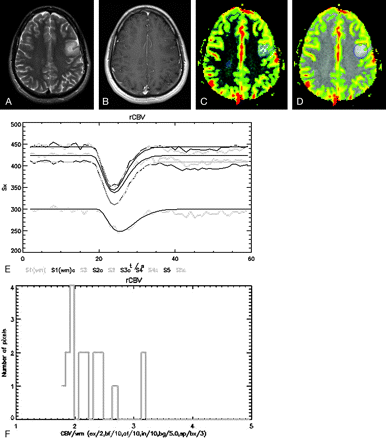 Fig 2.