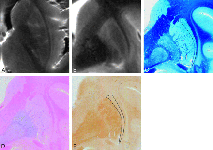 Fig 4.