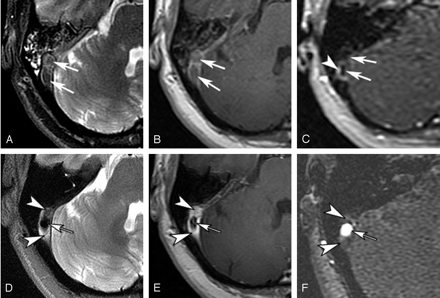 Fig 2.