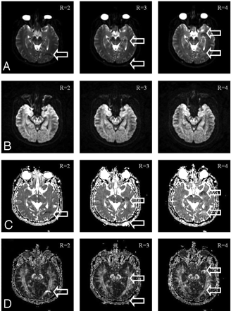 Fig 3.