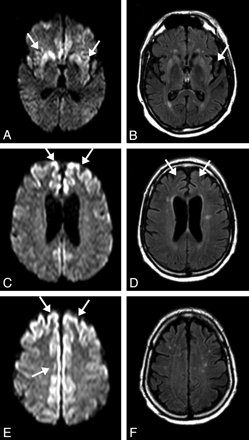 Fig 2.