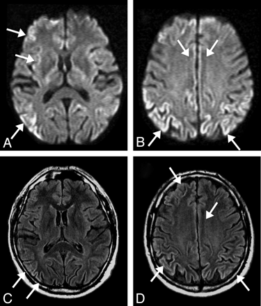 Fig 3.