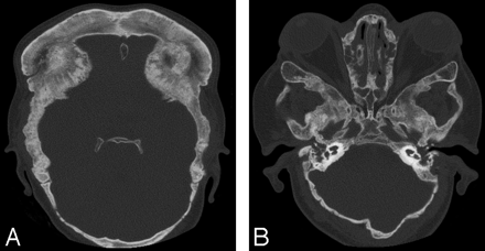Fig 1.