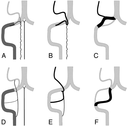 Fig 10.