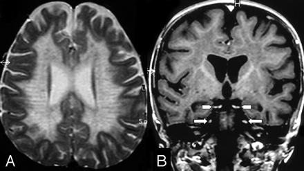   Fig 1. 