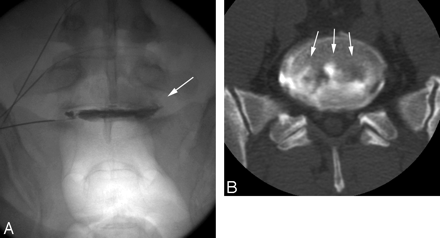 Fig 1.