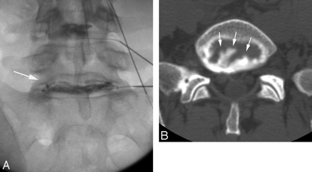 Fig 3.
