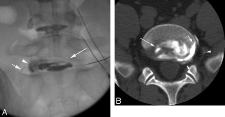 Fig 5.