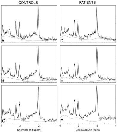 Fig 2.
