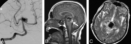   Fig 1. 