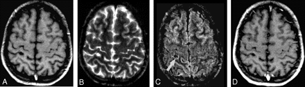 Fig 2.